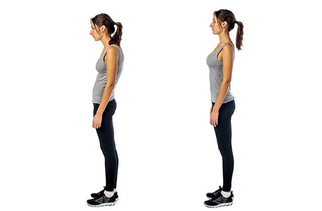 Assistance in improving poor posture